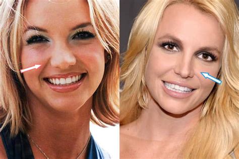 britney spears original nose|Britney Spears Nose Job 